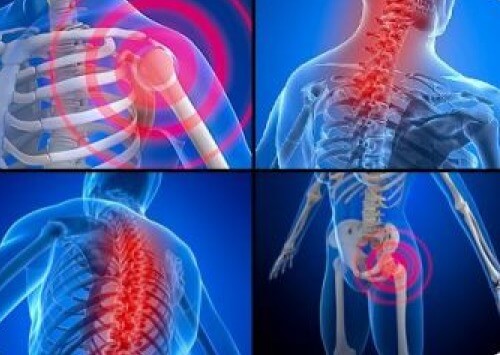 Fibromyalgie 2