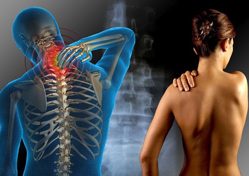 Fibromyalgie 5